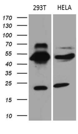 TEKT2 Monoclonal Antibody (OTI1E6), TrueMAB , OriGene:Antibodies:Primary