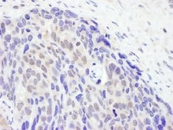 TET2 Rabbit anti-Human, Polyclonal, Bethyl Laboratories 100 &mu;L; Unconjugated:Antibodies,