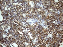 TET3 Monoclonal Antibody (OTI11E11), TrueMAB , OriGene 100 &mu;L; Unconjugated:Antibodies,