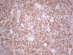 TET3 Monoclonal Antibody (OTI4B7), TrueMAB , OriGene 100 &mu;L; Unconjugated:Antibodies,