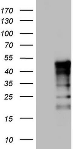 TET3 Monoclonal Antibody (OTI5A4), TrueMAB , OriGene 30 &mu;L; Unconjugated:Antibodies,