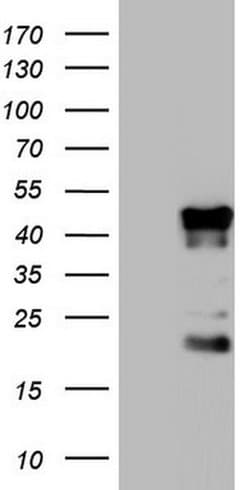 TET3 Monoclonal Antibody (OTI3G10), TrueMAB , OriGene 30 &mu;L; Unconjugated:Antibodies,