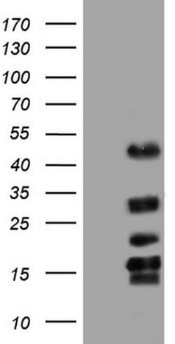 TET3 Monoclonal Antibody (OTI3B3), TrueMAB , OriGene 100 &mu;L | Buy Online | OriGene | Fisher Scientific