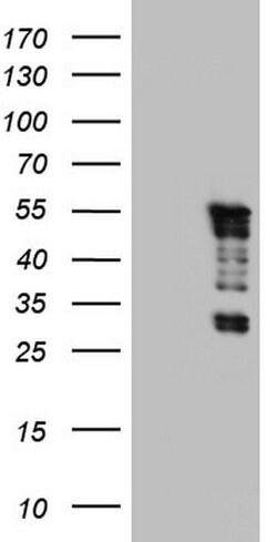 TET3 Monoclonal Antibody (OTI11E11), TrueMAB , OriGene 100 &mu;L; Unconjugated:Antibodies,