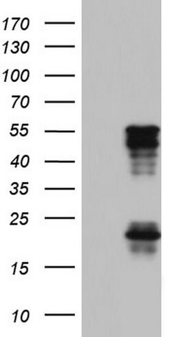 TET3 Mouse anti-Human, Clone: OTI2F10, lyophilized, TrueMAB 100 &mu;g;