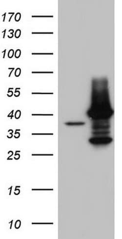 TFB1M Monoclonal Antibody (OTI3G8), TrueMAB , OriGene 30 &mu;L | Buy Online | Origene Technologies | Fisher Scientific