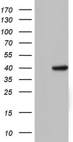 TFB1M Monoclonal Antibody (OTI13H2), TrueMAB , OriGene:Antibodies:Primary