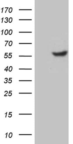 TFDP2 Monoclonal Antibody (OTI4C11), TrueMAB , OriGene 100 &mu;L; Unconjugated:Antibodies,