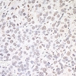 TFEB Rabbit anti-Human, Mouse, Polyclonal, Bethyl Laboratories 100 &mu;L;