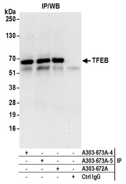 TFEB Rabbit anti-Human, Mouse, Polyclonal, Bethyl Laboratories 100 &mu;L;