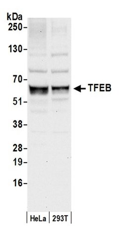 TFEB Polyclonal Antibody, Bethyl Laboratories 20 &mu;L; Unconjugated | Buy Online | Bethyl Laboratories, Inc | Fisher Scientific