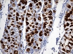 TFF1 Monoclonal Antibody (OTI2C8), TrueMAB , OriGene 100 &mu;L; Unconjugated:Antibodies,
