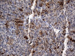 TFF1 Monoclonal Antibody (OTI2C8), TrueMAB , OriGene 100 &mu;L; Unconjugated:Antibodies,
