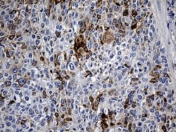 TFF1 Monoclonal Antibody (OTI1A4), TrueMAB , OriGene 100 &mu;L | Buy Online | Origene Technologies | Fisher Scientific
