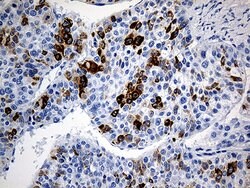 TFF1 Mouse anti-Human, Clone: OTI1F5, liquid, TrueMAB 100 &mu;L; Unconjugated:Antibodies,