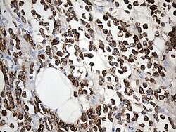 TFF1 Monoclonal Antibody (OTI7B12), TrueMAB , OriGene 100 &mu;L; Unconjugated:Antibodies,