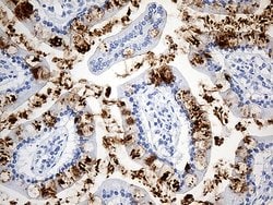 TFF1 Monoclonal Antibody (OTI7B12), TrueMAB , OriGene:Antibodies:Primary