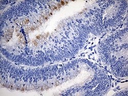 TFF1 Monoclonal Antibody (OTI7B12), TrueMAB , OriGene 100 &mu;L; Unconjugated:Antibodies,