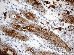 TFF1 Monoclonal Antibody (OTI7B12), TrueMAB , OriGene 100 &mu;L; Unconjugated:Antibodies,