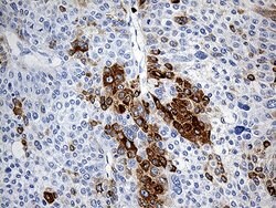 TFF1 Monoclonal Antibody (OTI7B12), TrueMAB , OriGene 100 &mu;L; Unconjugated:Antibodies,