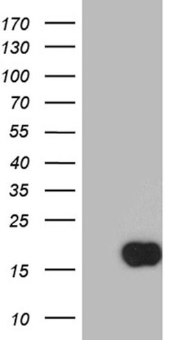 TFF1 Mouse anti-Human, Clone: OTI1F5, liquid, TrueMAB 100 &mu;L; Unconjugated:Antibodies,