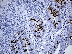 TFF3 Mouse anti-Human, Clone: OTI4D10, lyophilized, TrueMAB 100 &mu;g;