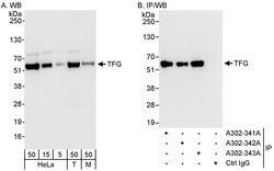 TFG Rabbit anti-Human, Mouse, Polyclonal, Bethyl Laboratories 100 &mu;l;
