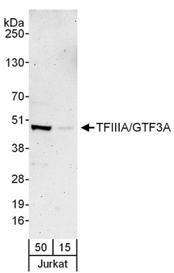 TFIIIA/GTF3A Rabbit anti-Human, Polyclonal, Bethyl Laboratories 100 &mu;L | Buy Online | Bethyl Laboratories, Inc | Fisher Scientific