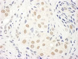 TFIIS Rabbit anti-Human, Polyclonal, Bethyl Laboratories 10 &mu;L; Unconjugated:Antibodies,