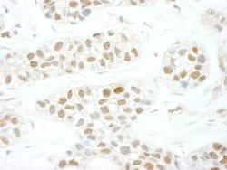 TFIIS Polyclonal Antibody, Bethyl Laboratories 10 &mu;L; Unconjugated:Antibodies,