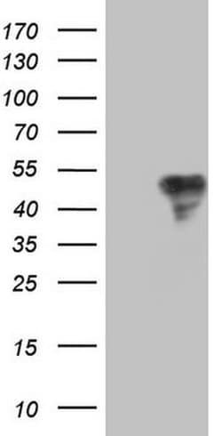 TFPI Monoclonal Antibody (OTI4H9), TrueMAB , OriGene 100 &mu;L | Buy Online | OriGene | Fisher Scientific