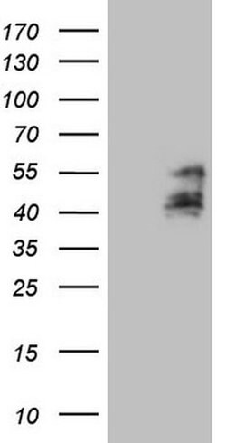 TFPI Monoclonal Antibody (OTI2B10), TrueMAB , OriGene:Antibodies:Primary