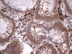 TFPI2 Mouse anti-Human, Clone: OTI1G3, lyophilized, TrueMAB 100 &mu;g;