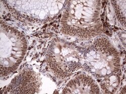 TFPI2 Monoclonal Antibody (OTI1G3), TrueMAB , OriGene 100 &mu;L; Unconjugated:Antibodies,
