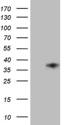 TFPI2 Mouse anti-Human, Clone: OTI1H10, lyophilized, TrueMAB 100 &mu;g;