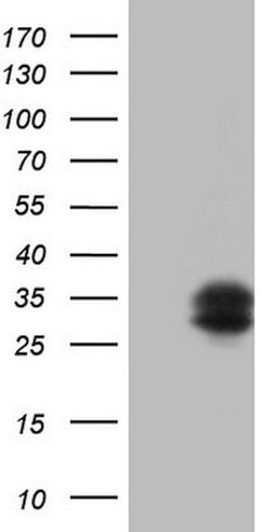TFPI2 Mouse anti-Human, Clone: OTI1G3, lyophilized, TrueMAB 100 &mu;g;