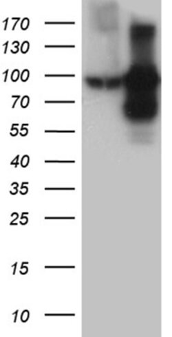 TFRC Mouse anti-Human, Clone: OTI6H9, lyophilized, TrueMAB 100 &mu;g; Unconjugated:Antibodies,