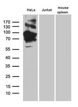TFRC Mouse anti-Human, Clone: OTI6H9, lyophilized, TrueMAB 100 &mu;g; Unconjugated:Antibodies,