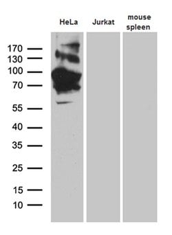 TFRC Monoclonal Antibody (OTI6H9), TrueMAB , OriGene:Antibodies:Primary