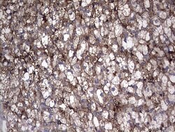 TG Monoclonal Antibody (OTI8E8), TrueMAB , OriGene 100 &mu;L; Unconjugated:Antibodies,