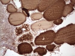 TG Monoclonal Antibody (OTI8F7), TrueMAB , OriGene:Antibodies:Primary Antibodies