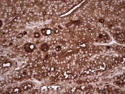 TG Monoclonal Antibody (OTI8F7), TrueMAB , OriGene 100 &mu;L; Unconjugated:Antibodies,