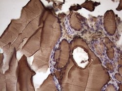 TG Monoclonal Antibody (OTI8F4), TrueMAB , OriGene:Antibodies:Primary Antibodies