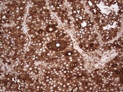 TG Mouse anti-Human, Clone: OTI8D5, TrueMAB , Origene 30 &mu;L; Unconjugated:Antibodies,