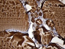 TG Monoclonal Antibody (OTI2B9), TrueMAB , OriGene:Antibodies:Primary Antibodies