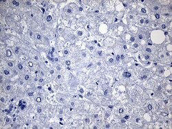 TG Monoclonal Antibody (OTI2B9), TrueMAB , OriGene:Antibodies:Primary Antibodies
