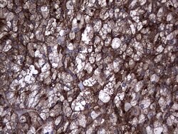 TG Monoclonal Antibody (OTI1F1), TrueMAB , OriGene:Antibodies:Primary Antibodies
