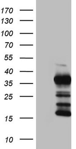 TG Monoclonal Antibody (OTI3E12), TrueMAB , OriGene 100 &mu;L; Unconjugated:Antibodies,