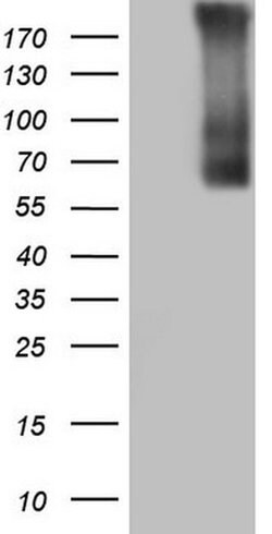 TG Monoclonal Antibody (OTI8E6), TrueMAB , OriGene:Antibodies:Primary Antibodies
