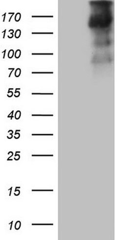 TG Monoclonal Antibody (OTI8E4), TrueMAB , OriGene:Antibodies:Primary Antibodies